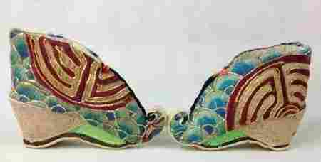 古代病态审美束腰裹脚,古代小脚畸形