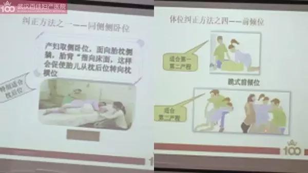 自由体位分娩用力技巧,自由体位分娩学习