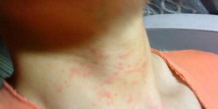 夏季如何防晒保护皮肤,孕妇要怎么护理皮肤