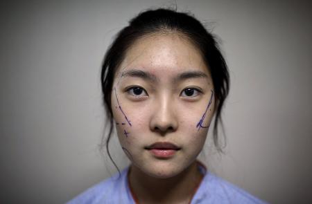 整容失败该怎么调整心态,整容失败了该怎么维护自己