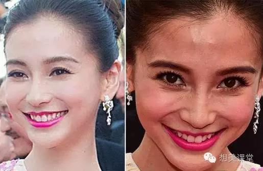 脸再美妆再浓，一颗痘痘毁你容！