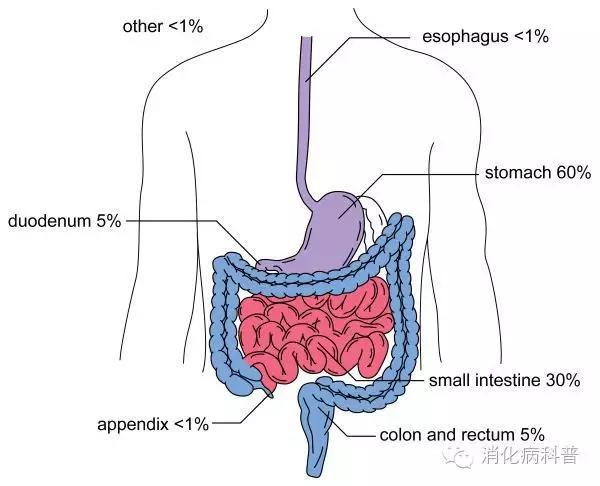 胃肠间质瘤恶性高危转移度大不大,胃肠间质瘤转移肝是恶性肿瘤吗