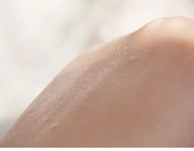 雅漾喷雾适合夏天用吗,你现在还在用雅漾补水喷雾吗