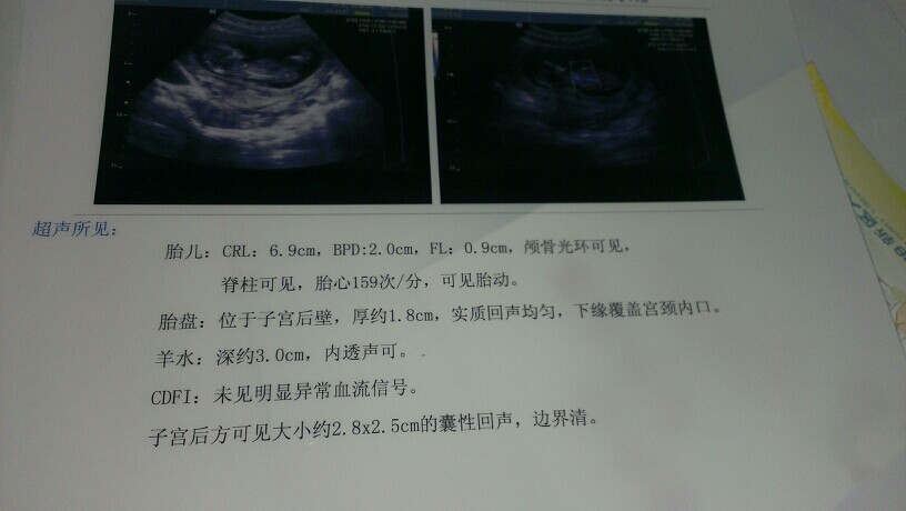 看懂25大特征，轻松生个大胖小子，你中了几条呢