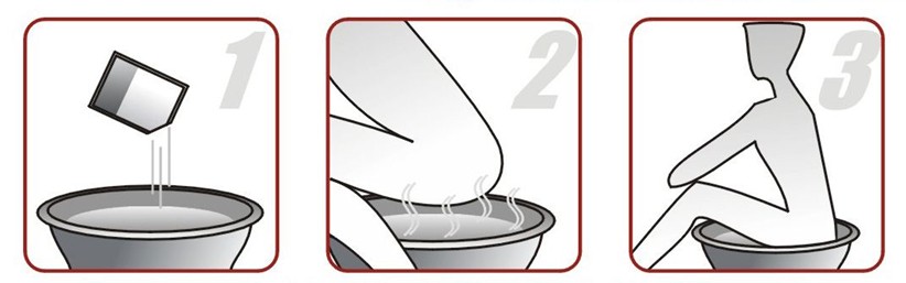 肛裂手术后25天亲身经历,肛裂手术后患者的感受