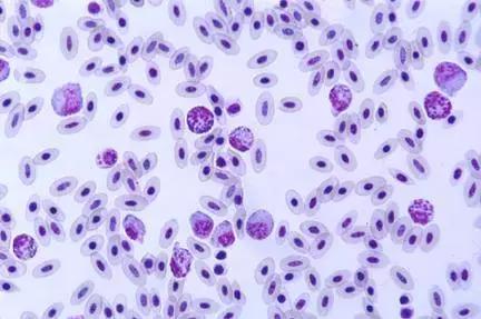 如果小鸟受伤了该怎么救助,野生小鸟受伤了怎么救它的