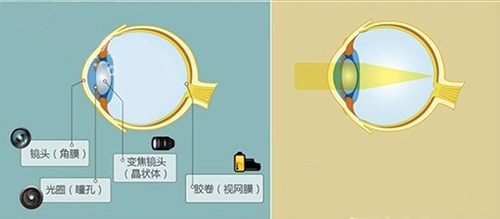 散光是怎么回事有了散光该怎么办,左眼400度散光右眼300度散光