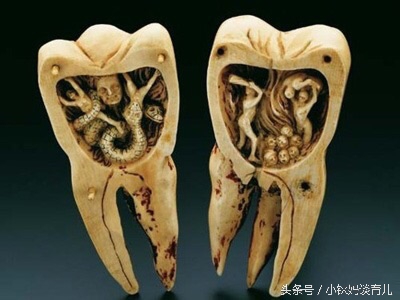 乳牙掉了没牙根怎么补牙,儿童乳牙龋齿烂了有必要补牙吗