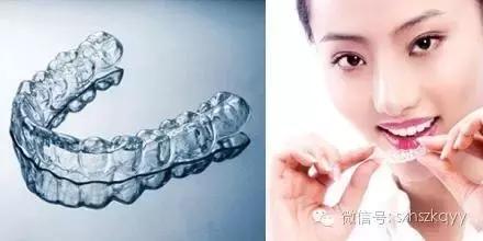 常见排齐牙齿的四大方法,牙齿拥挤重叠矫正过程