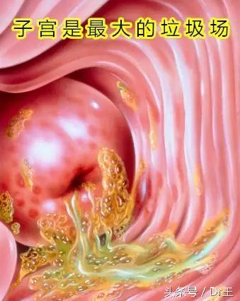 子宫的日常保健法，这样做，包你有一个优质的子宫！