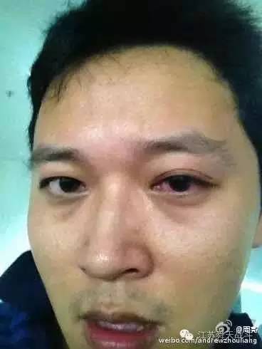 解说周亮,周亮解说完整视频