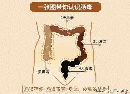 便秘烦恼孕期,孕期便秘很难缠