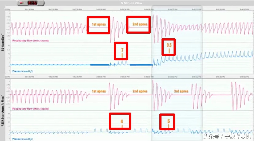 瑞思迈s9autoset-s的价格,瑞思迈s9autoset-s评测