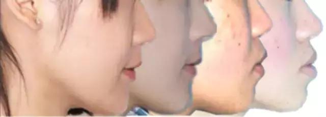 正畸专家介绍图,正畸医生关于整牙的10条建议