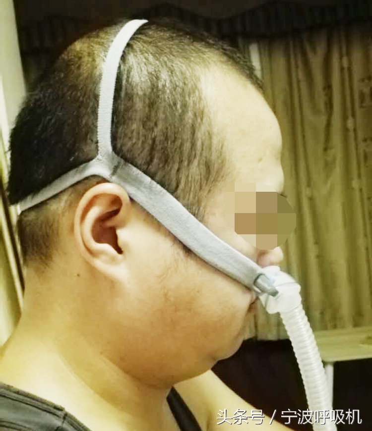 瑞思迈呼吸机面罩,瑞思迈呼吸机s9口鼻面罩