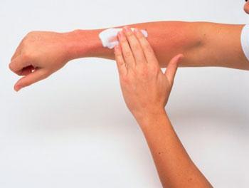 湿疹的最佳治疗药物,湿疹擦什么药膏效果好能治好