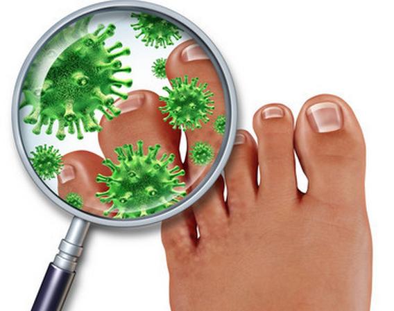 治疗脚气不杀真菌,用洪荒之力也止不了痒