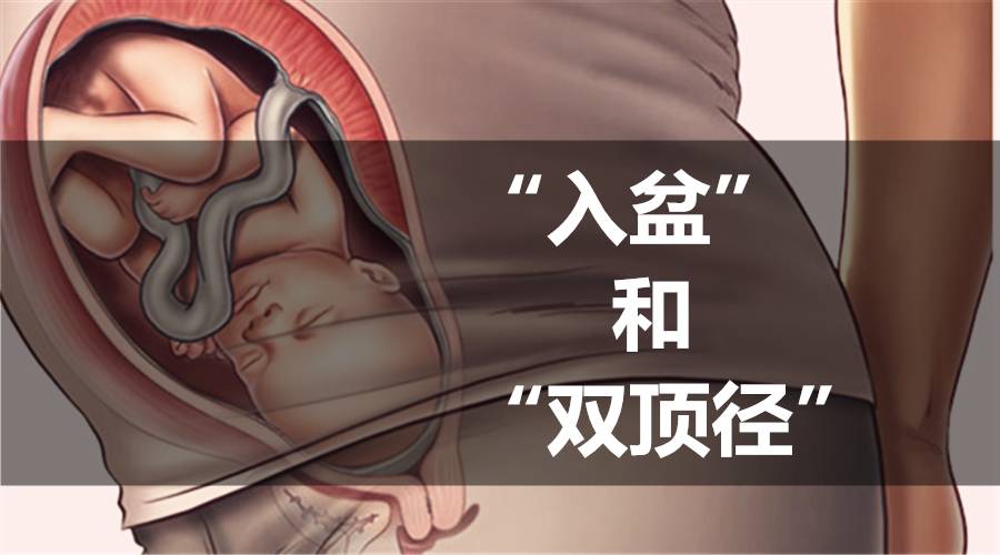 你问我答之“入盆”和“双顶径”