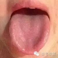 身体最健康舌头是怎么样的,健康人是什么体质