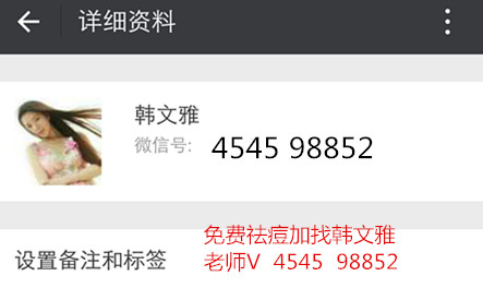 祛痘淡化痘印男女皆可,祛痘不留疤痕最有效方法