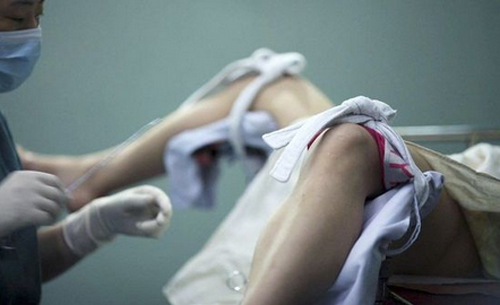 无痛清宫和无痛人流的区别,无痛人流真的无痛吗