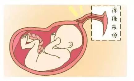 女人生孩子为什么会痛？