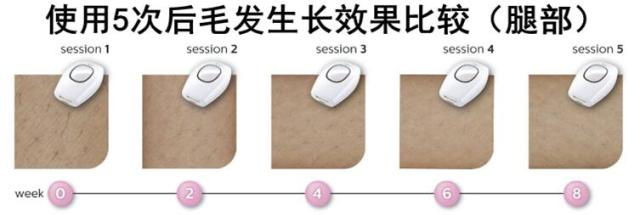 如何选择家用脱毛仪,适合嫩肤的脱毛仪