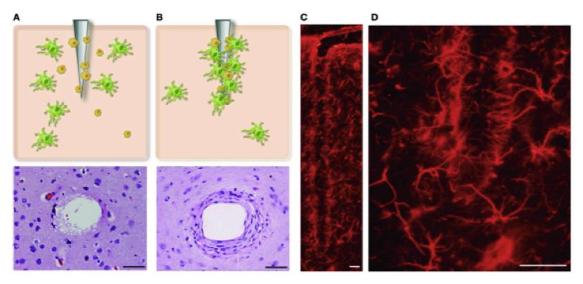 霍金脑机接口原理,从霍金到爱因斯坦的宇宙视频