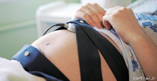 产检胎心率150以上,胎心昨天超过160今天120