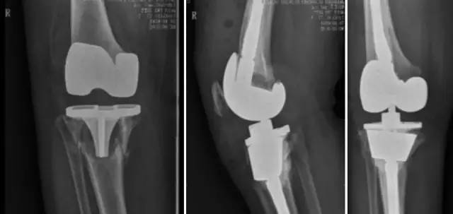 杏林秋实清华长庚骨科·关节外科中心