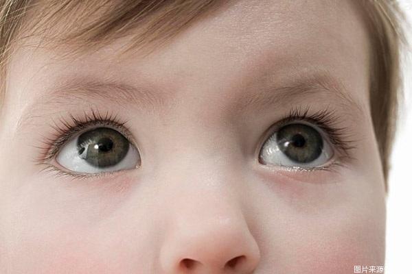 宝宝眼睛病有哪些,宝宝眼睛生病了怎么办