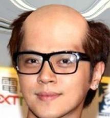 寿星头好还是不好,额头凸起寿星头是什么病