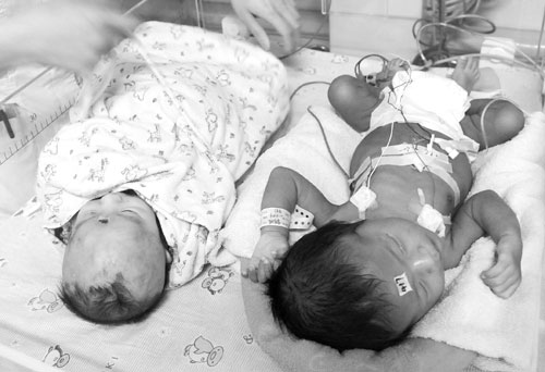 从夫妻生下非洲宝宝，小编有话说