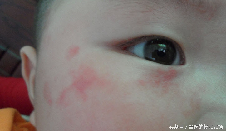 如何护理好宝宝的皮肤,怎么给宝宝身体保湿护肤呢