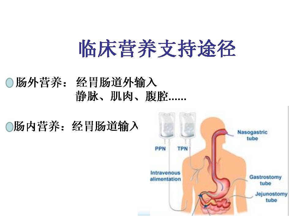 营养网课件胡阳,海安人民医院:危重患者营养支持实践