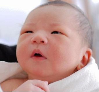 宝宝湿疹奶癣怎么消除,婴儿湿疹奶癣擦什么药膏