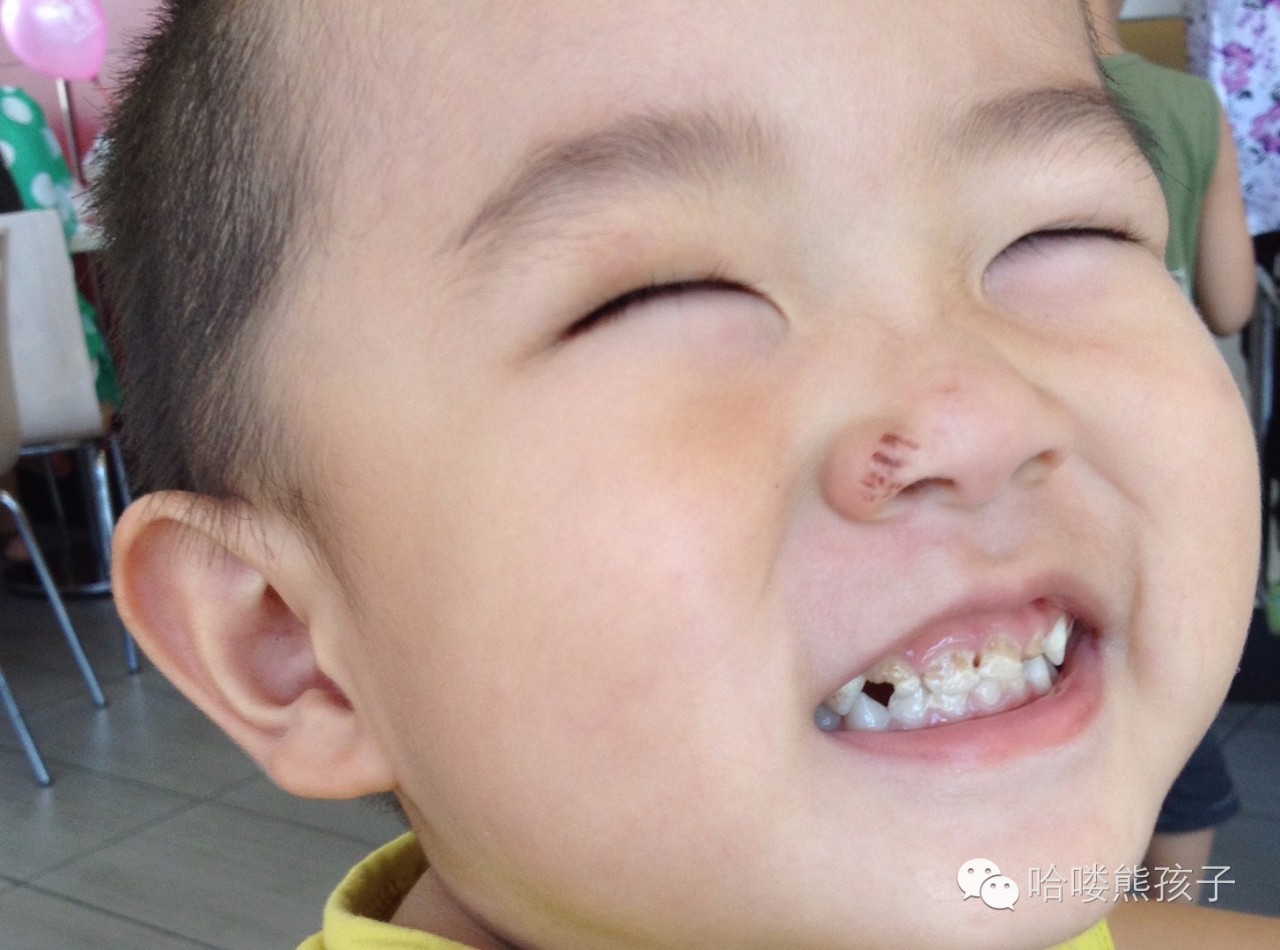 滚蛋吧，蛀牙～！