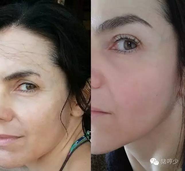 眼周很多小细纹用什么眼膜比较好,眼周保养只擦眼霜