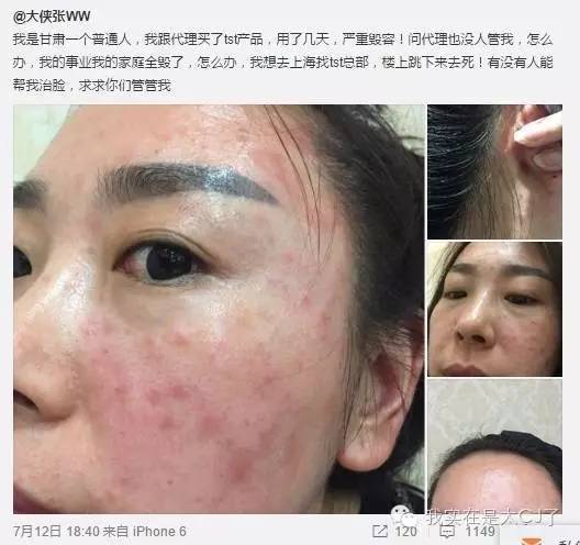 张庭现身微商宣传活动,张庭最新微商消息