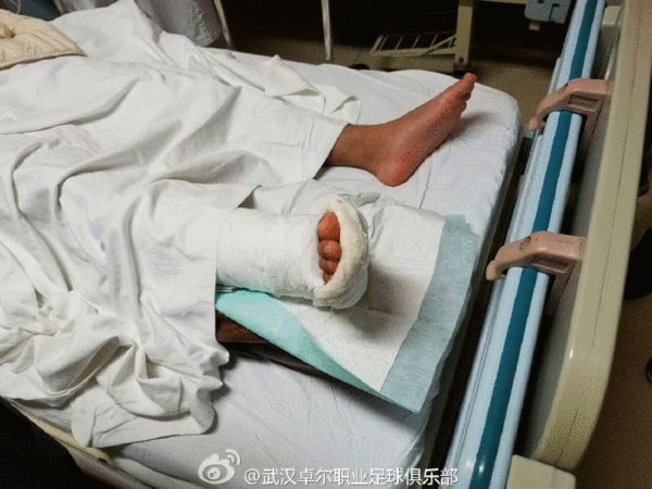 足坛断腿骨头外露,中国足球铲断腿