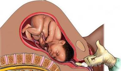 分娩前后知识大扫盲！临产了，入院后竟还有这么多检查！