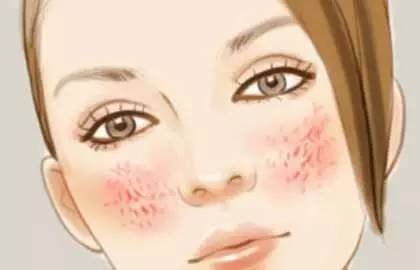 去中医看痘痘需要几个疗程,三甲医院治痘痘全过程