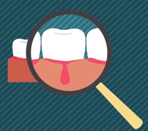 健康口腔保护牙齿,健康口腔龋齿