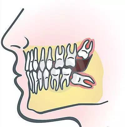 健康口腔保护牙齿,健康口腔龋齿
