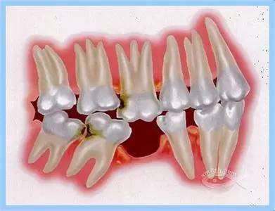 健康口腔保护牙齿,健康口腔龋齿