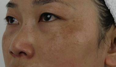 美白丸怎么用才是正确的,美白丸哪个牌子效果好知乎