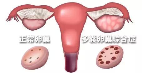 卵巢在孕期起到什么作用,孕期卵巢囊肿怎么办