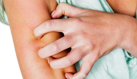 麻疹能治断根吗,麻疹治得好吗