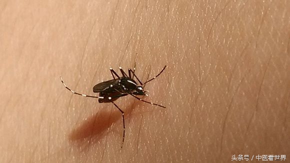 身体出现红色小点是什么病,皮肤上出现红色血管线