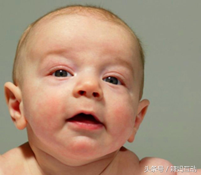 孕妇产后长湿疹怎么办,产后长了湿疹